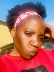 Refortia After Undergoing Treatment For Her Adult Acne