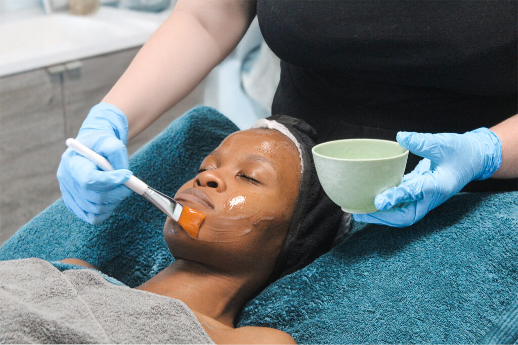 A woman receiving Bio-Needling with Spongilla Spicules at The Laser Beautqiue